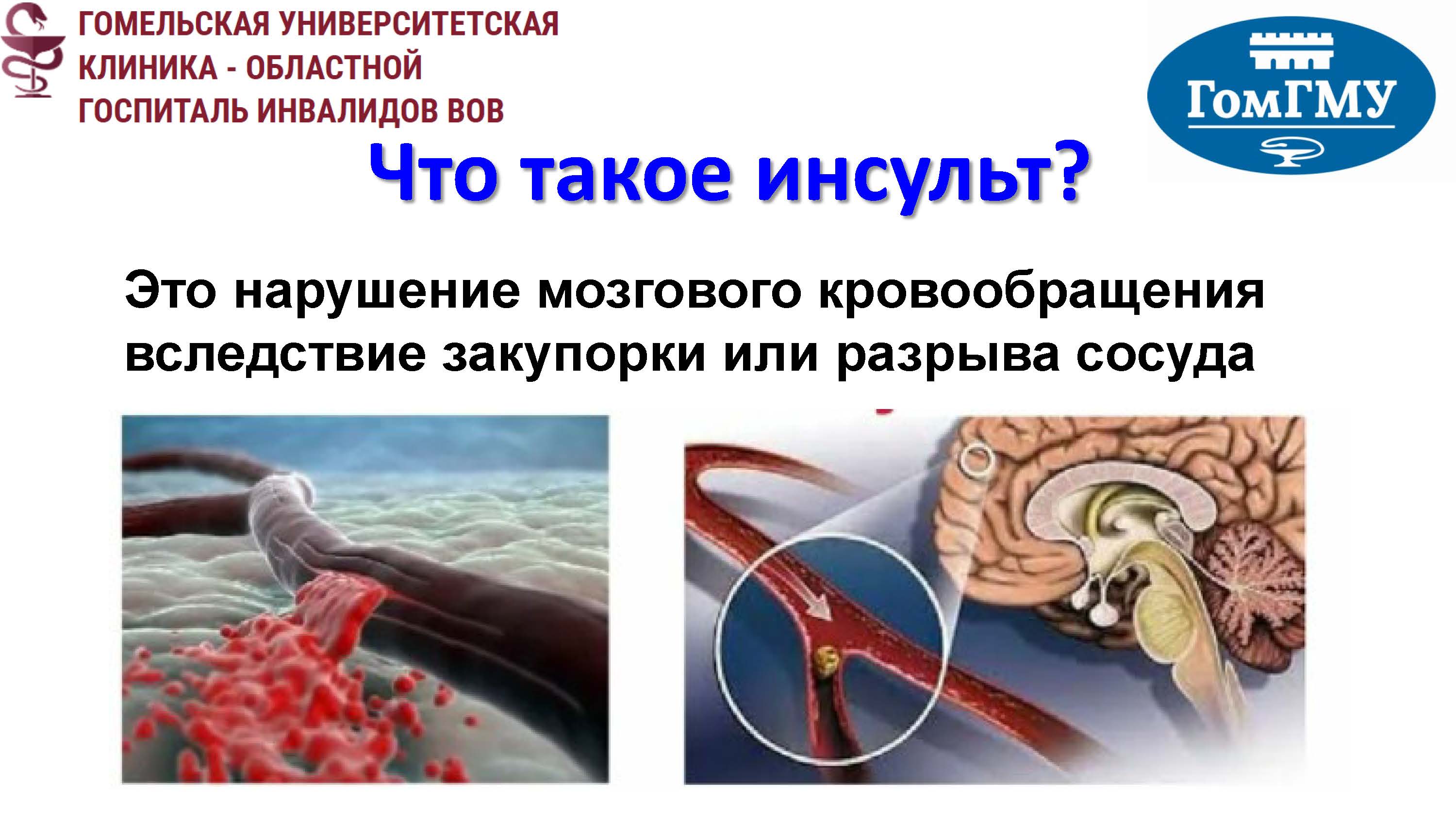 инсульт памятка Страница 1